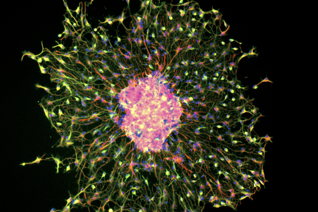 Neural stem cells under a microscope
